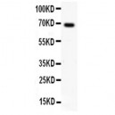 Mesothelin Antibody