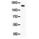 Met(c-Met)  Antibody