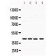 MICA  Antibody