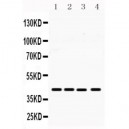 MICA  Antibody