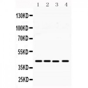 MICA  Antibody