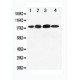 Mineralocorticoid Receptor Antibody