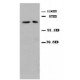 Mitofusin 2 Antibody