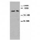 Mitofusin 2 Antibody