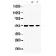 MMP10  Antibody