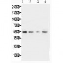 MMP10 Antibody