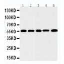 MMP12 Antibody