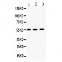 MMP14  Antibody