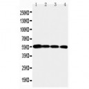 MMP24 Antibody