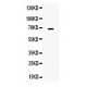 MMP9  Antibody