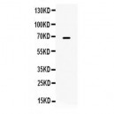 MMP9  Antibody