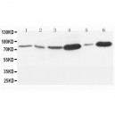 MMP9 Antibody