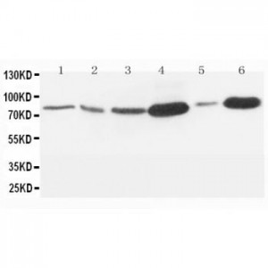 MMP9 Antibody