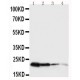 mouse Growth Hormone Antibody