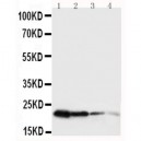 mouse Growth Hormone Antibody