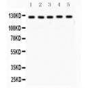 MSH3  Antibody