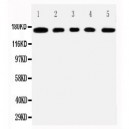 MUC1 Antibody