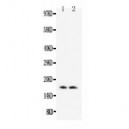 Myoglobin Antibody