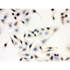 NCAM Antibody (monoclonal)