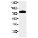 NCSTN Antibody