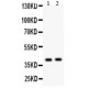 NDRG2 Antibody