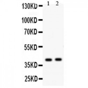 NDRG2 Antibody