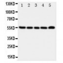 Neurokinin 1 Receptor Antibody