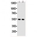 NFkB p100/p52 Antibody