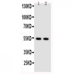 NFkB p100/p52 Antibody