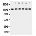 NFkB p105/p50 Antibody