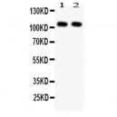 NFkB p105/p50 Antibody