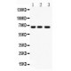 NF-kB p65  Antibody