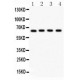 NF-kB p65  Antibody