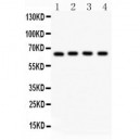 NF-kB p65  Antibody