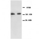 NF-kB p65 Antibody