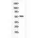 Nicotinic Acetylcholine Receptor alpha 1 Antibody