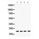 NM23A Antibody