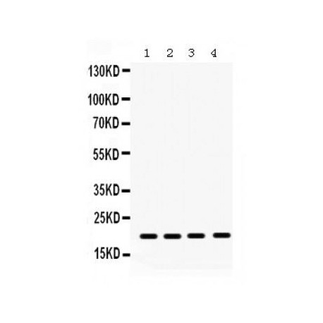 NM23A Antibody