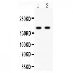 NMDAR2A  Antibody