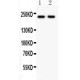 NMDAR2B  Antibody