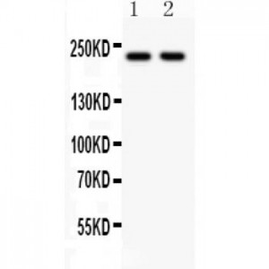 NMDAR2B  Antibody