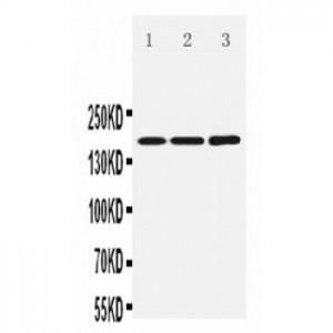 NMDAR2B Antibody