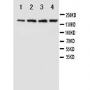 NMDAR2B Antibody