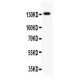 NMDAR2C  Antibody