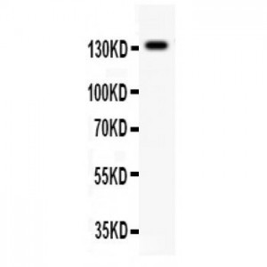 NMDAR2C  Antibody