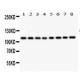 NOS2 Antibody