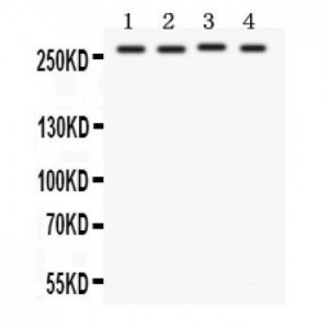 Notch1 Antibody