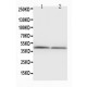 NPHS2 Antibody