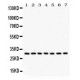 NQO1  Antibody