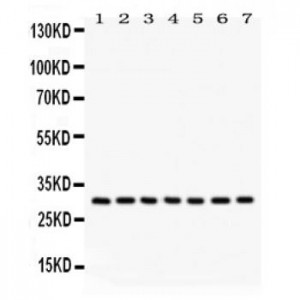 NQO1  Antibody